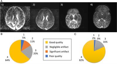 High resolution and contrast 7 tesla MR brain imaging of the neonate